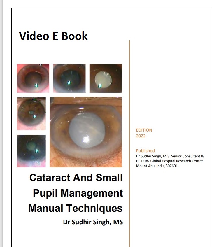 Small Pupil And Cataract Management Techniques BOOK